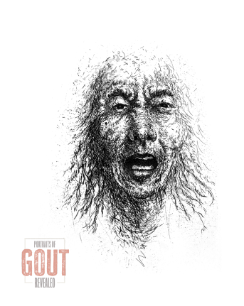 Portraits of Gout Revealed