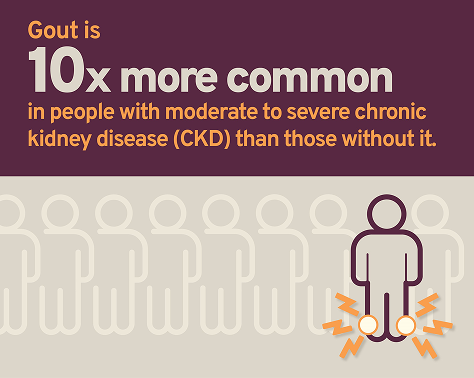 gout is 10x more common